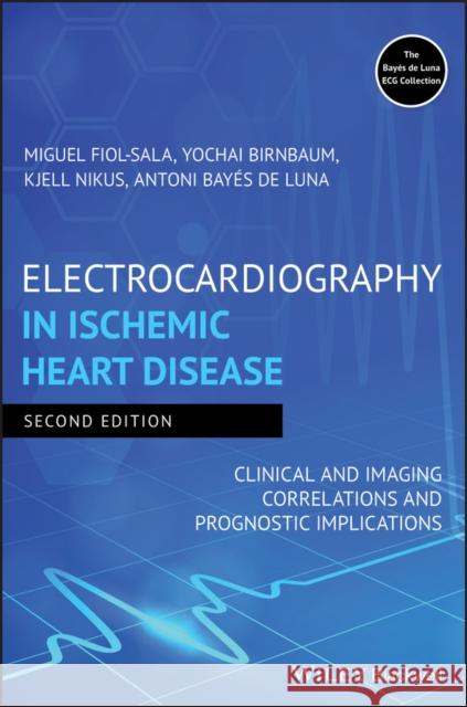 Electrocardiography in Ischemic Heart Disease Miguel Fiol–Sala, Yochai Birnbaum, Kjell Nikus 9781119422662