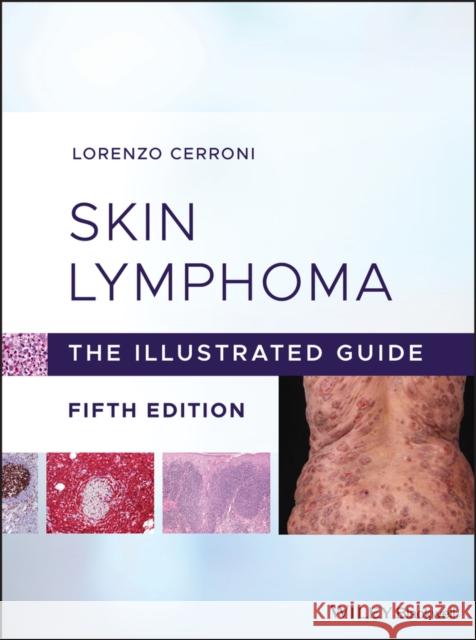 Skin Lymphoma: The Illustrated Guide Cerroni, Lorenzo 9781119485902 John Wiley and Sons Ltd