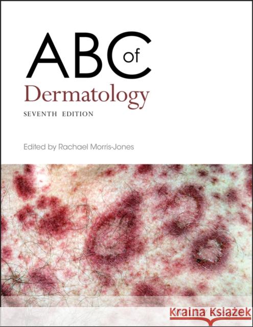 ABC of Dermatology Rachael Morris-Jones 9781119488989