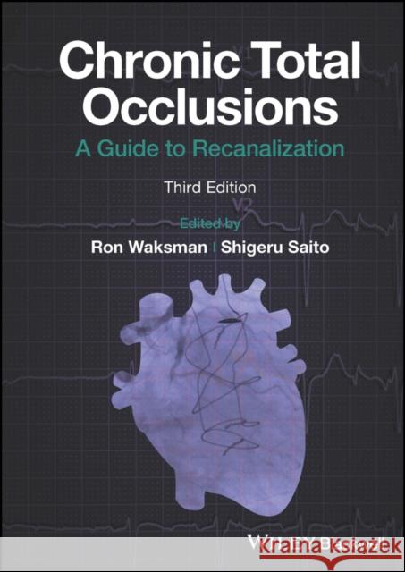 Chronic Total Occlusions: A Guide to Recanalization Ron Waksman Shigeru Saito  9781119517276