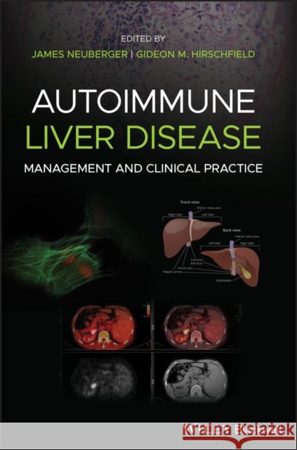 Autoimmune Liver Disease: Management and Clinical Practice Neuberger, James 9781119532606 Wiley-Blackwell