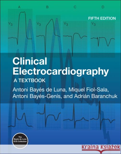Clinical Electrocardiography: A Textbook Bay Adrian Baranchuk Miguel Fiol-Sala 9781119536451 Wiley