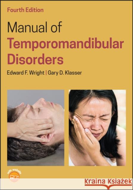Manual of Temporomandibular Disorders Edward F. Wright Gary D. Klasser 9781119548843 Wiley-Blackwell