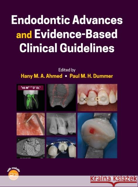 Endodontic Advances and Evidence-Based Clinical Guidelines  9781119553885 John Wiley and Sons Ltd