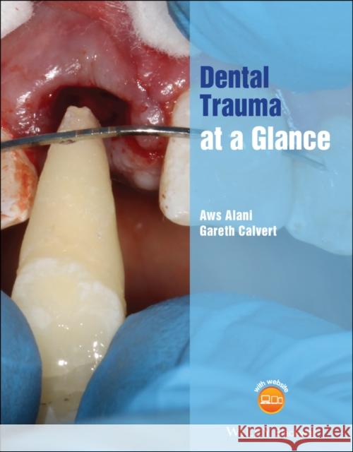 Dental Trauma at a Glance Aws Alani Gareth Calvert 9781119562832 Wiley-Blackwell