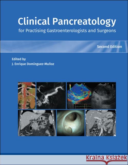 Clinical Pancreatology for Practising Gastroenterologists and Surgeons Dominguez-Munoz, Juan Enrique 9781119570073