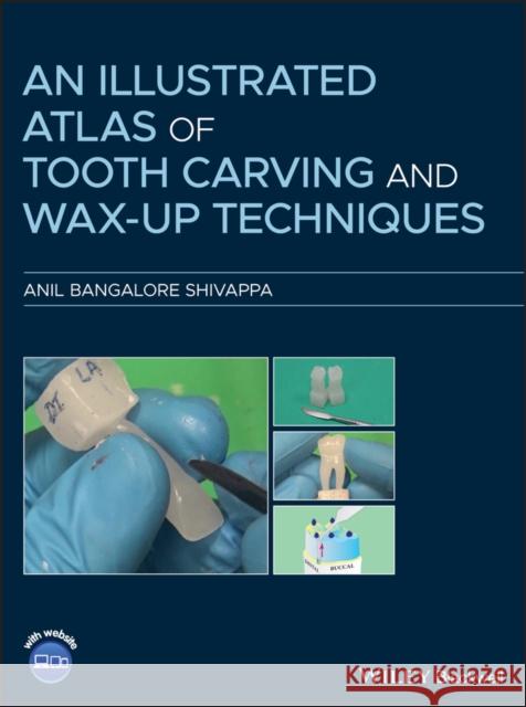 An Illustrated Atlas of Tooth Carving and Wax-Up Techniques Anil Bangalor 9781119573586 Wiley-Blackwell