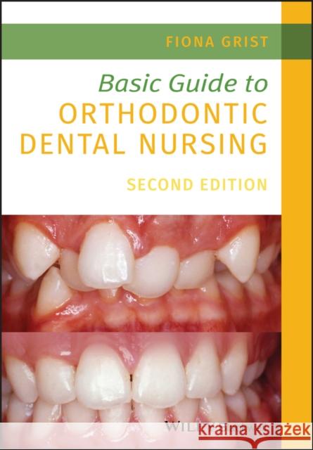 Basic Guide to Orthodontic Dental Nursing Fiona Grist 9781119573692 John Wiley and Sons Ltd