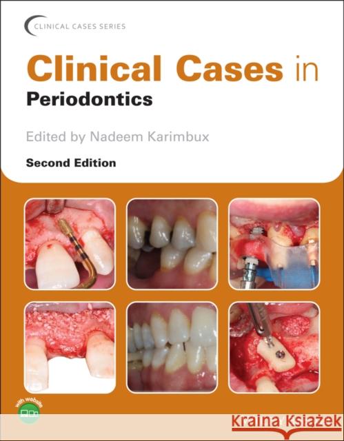 Clinical Cases in Periodontics Nadeem Karimbux 9781119583950 Wiley-Blackwell