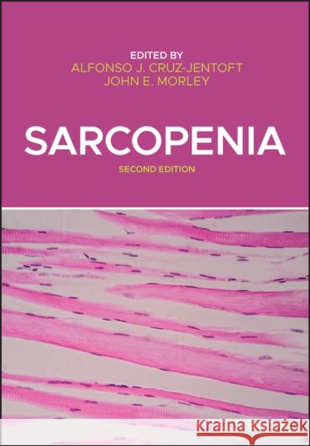 Sarcopenia Alfonso A. Cruz-Jentoft John E. Morley 9781119597872 Wiley-Blackwell