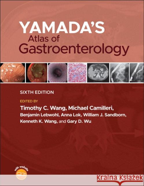 Yamada's Atlas of Gastroenterology Michael Camilleri Timothy C. Wang 9781119600428 Wiley-Blackwell