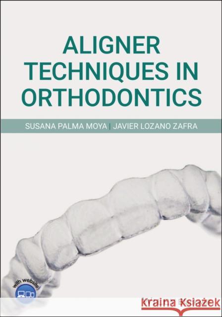 Aligner Techniques in Orthodontics Javier Lozan Susana Palm 9781119607229 Wiley-Blackwell