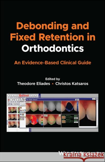 Debonding and Fixed Retention in Orthodontics: An Evidence-Based Clinical Guide T Eliades 9781119623953 John Wiley and Sons Ltd