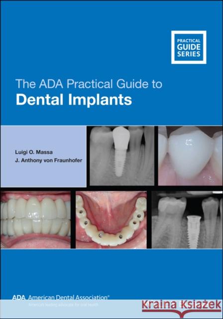 The ADA Practical Guide to Dental Implants Massa, Luigi O. 9781119630692 
