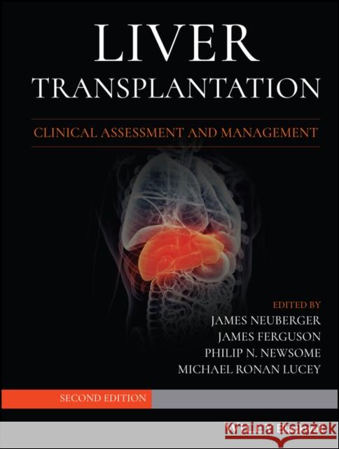 Liver Transplantation James Neuberger James Ferguson Philip N. Newsome 9781119633983 Wiley-Blackwell