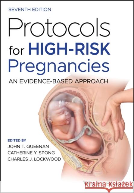 Protocols for High-Risk Pregnancies: An Evidence-Based Approach Queenan, John T. 9781119635260