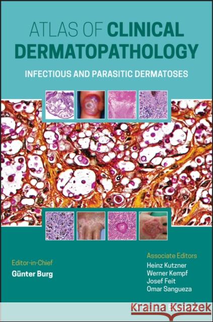 Atlas of Clinical Dermatopathology: Infectious and Parasitic Dermatoses Burg, Günter 9781119647065
