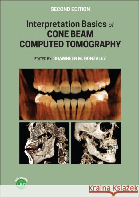 Interpretation Basics of Cone Beam Computed Tomography Shawneen M. Gonzalez 9781119685845 Wiley-Blackwell