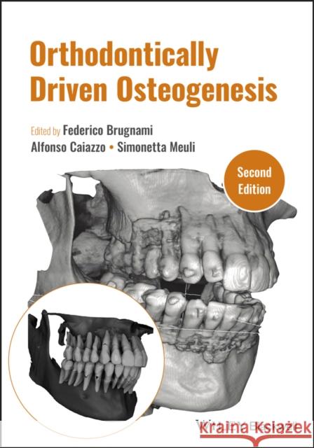 Orthodontically Driven Osteogenesis  9781119700562 Wiley