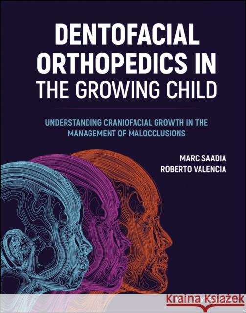 Dentofacial Orthopedics in the Growing Child: Understanding Craniofacial Growth in the Management of Malocclusions Saadia, Marc 9781119720188 John Wiley and Sons Ltd