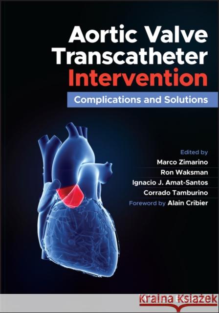 Aortic Valve Transcatheter Intervention: Complications and Solutions Zimarino, Marco 9781119720591 Wiley-Blackwell