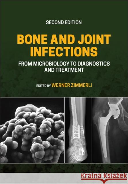 Bone and Joint Infections: From Microbiology to Diagnostics and Treatment Werner Zimmerli 9781119720652 Wiley-Blackwell