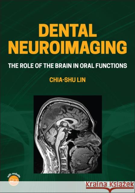 Dental Neuroimaging: The Role of the Brain in Oral Functions Chia-Shu Lin 9781119724209 Wiley-Blackwell