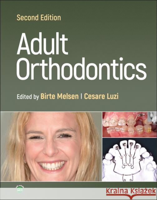 Adult Orthodontics  9781119775775 John Wiley and Sons Ltd