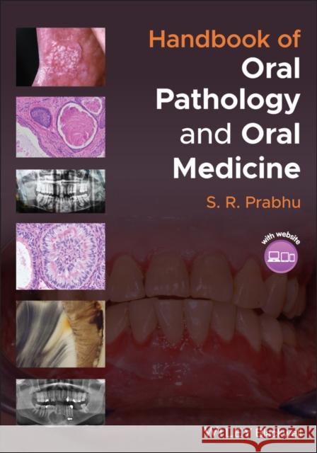 Handbook of Oral Pathology and Oral Medicine S. R. Prabhu 9781119781127 Wiley-Blackwell