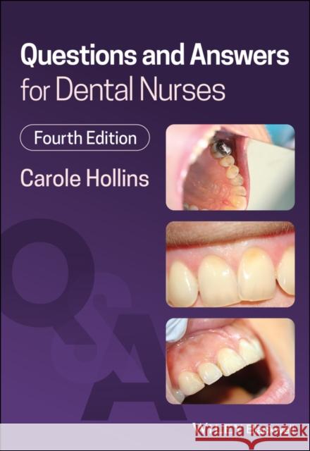 Questions and Answers for Dental Nurses Carole Hollins 9781119785200 John Wiley and Sons Ltd