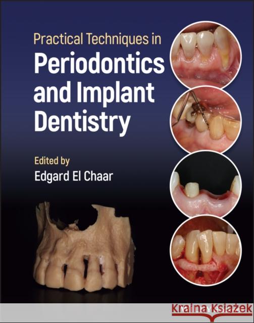 Practical Techniques in Periodontics and Implant Dentistry  9781119793557 