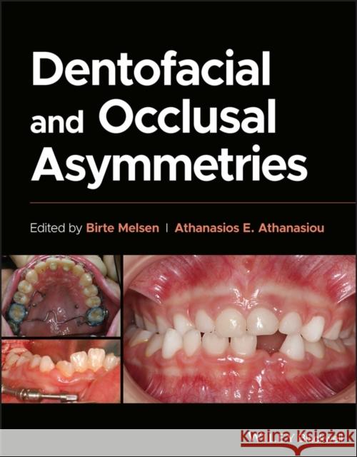 Dentofacial and Occlusal Asymmetries Melsen 9781119794813 John Wiley & Sons Inc