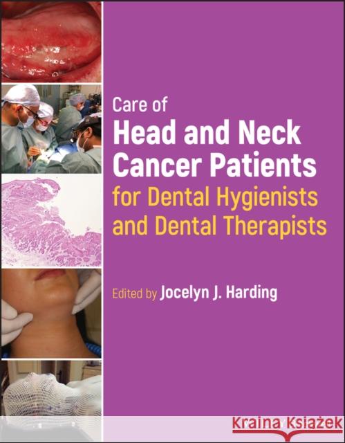 Care of Head and Neck Cancer Patients for Dental Hygienists and Dental Therapists Harding, Jocelyn J. 9781119795001 Wiley-Blackwell