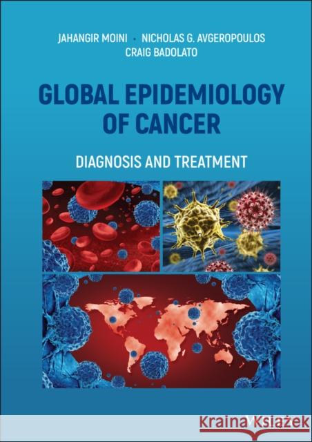 Global Epidemiology of Cancer: Diagnosis and Treatment Moini, Jahangir 9781119817444