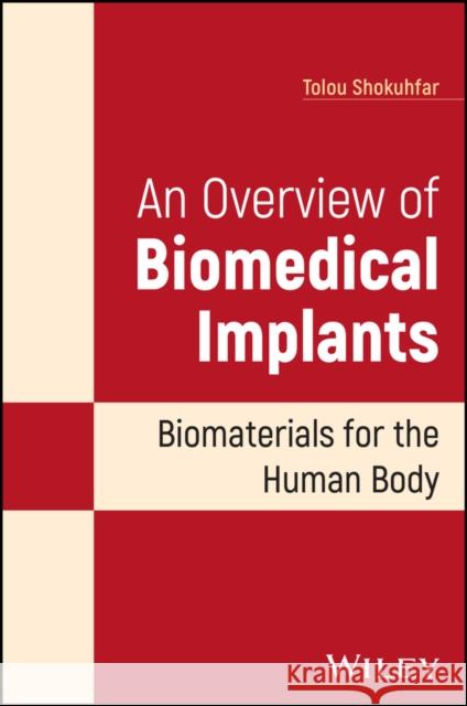 An Overview of Biomedical Implants: Biomaterials for the Human Body Tolou Shokuhfar 9781119850977 John Wiley & Sons Inc