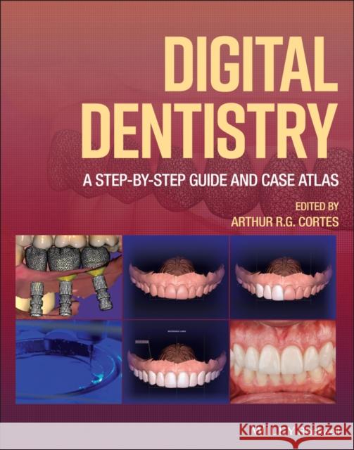 Digital Dentistry: A Step-By-Step Guide and Case Atlas Cortes, Arthur R. G. 9781119851998 John Wiley and Sons Ltd