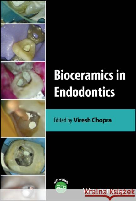 Clinical Atlas on Bioceramics in Endodontics  9781119898443 