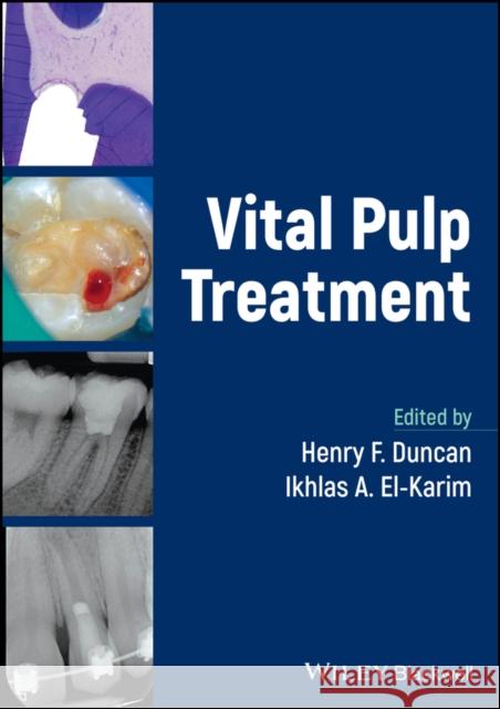 Vital Pulp Treatment  9781119930389 