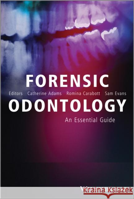 Forensic Odontology: An Essential Guide Adams, Catherine 9781119961451 John Wiley & Sons