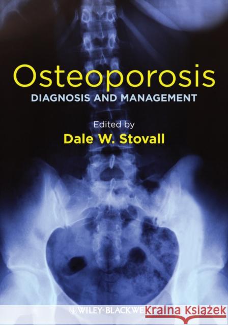 Osteoporosis: Diagnosis and Management Stovall, Dale W. 9781119968917 John Wiley & Sons