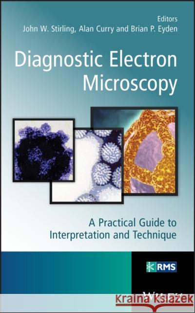 Diagnostic Electron Microscopy: A Practical Guide to Interpretation and Technique Stirling, John 9781119973997