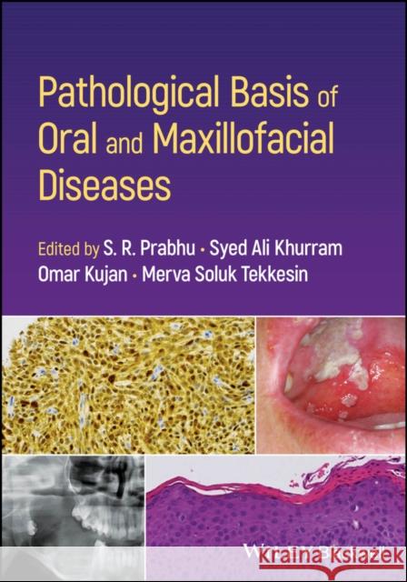 Pathological Basis of Oral and Maxillofacial Diseases  9781119989202 