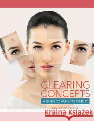 Clearing Concepts: A Guide to Acne Treatment Lees, Mark 9781133280316