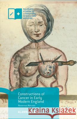 Constructions of Cancer in Early Modern England: Ravenous Natures Skuse, Alanna 9781137487520 Palgrave MacMillan