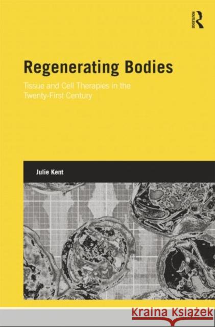 Regenerating Bodies: Tissue and Cell Therapies in the Twenty-First Century Kent, Julie 9781138020115