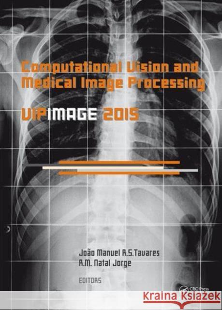 Computational Vision and Medical Image Processing V: Proceedings of the 5th Eccomas Thematic Conference on Computational Vision and Medical Image Proc Joao Manuel R. S. Tavares R. M. Natal Jorge  9781138029262