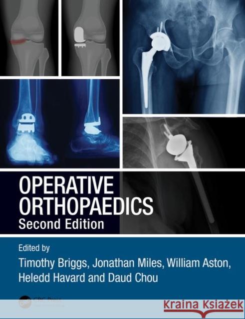 Operative Orthopaedics: The Stanmore Guide Miles, Jonathan 9781138031760