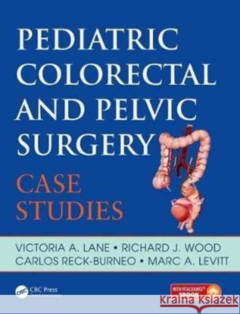 Pediatric Colorectal and Pelvic Surgery: Case Studies Victoria Lane Carlos Reck Richard J. Wood 9781138031777 CRC Press