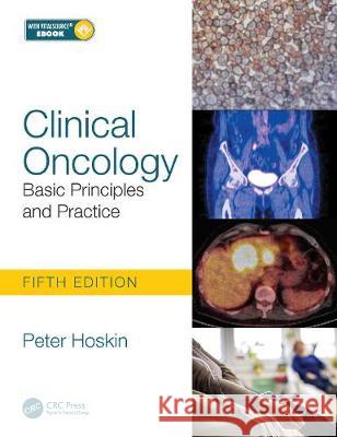 Clinical Oncology: Basic Principles and Practice Peter Hoskin Peter Ostler Robert Glynne-Jones 9781138035553 