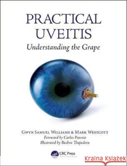 Practical Uveitis: Understanding the Grape Gwyn Williams Mark Westcott 9781138035751